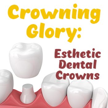 Salt Lake City dentist, Dr. Brickey at Natural Smiles Dentistry talks about the different options you might choose between if you need a dental crown.