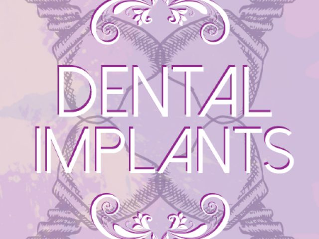 4 Facts about Dental Implants (featured image)